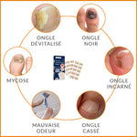 Patchs Correcteurs d'Ongles Incarnés