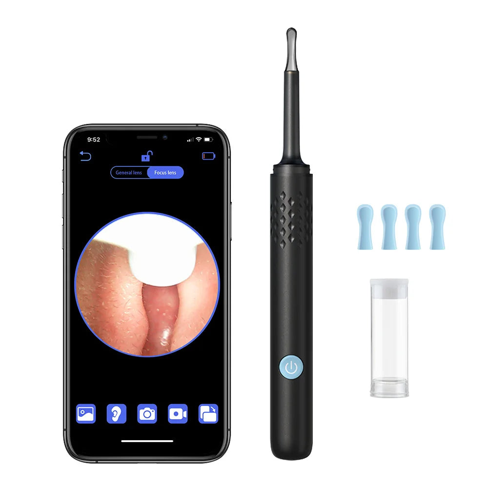 Nettoyeur d'oreille électronique avec caméra endoscopique intégrée - Livraison Offerte