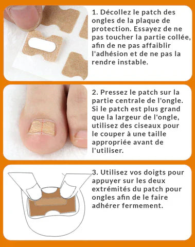 Patchs Correcteurs d'Ongles Incarnés